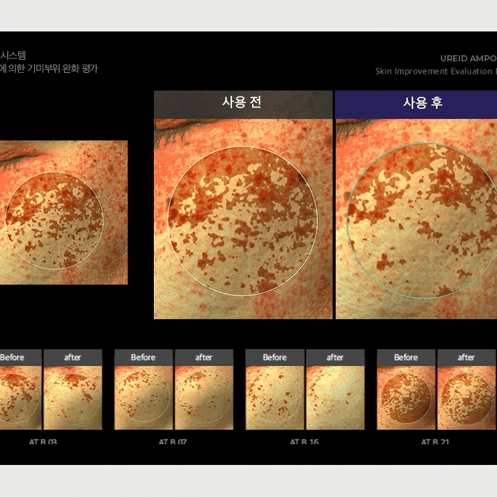 비에논 우레이드 기미앰플 검버섯 흑자 나이아신아마이드 미백앰플 상세 이미지 2