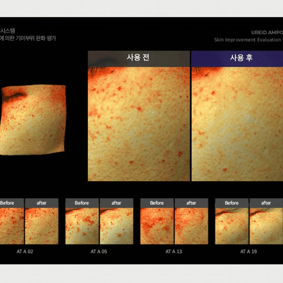 비에논 우레이드 기미앰플 검버섯 흑자 나이아신아마이드 미백앰플 상세 이미지 4